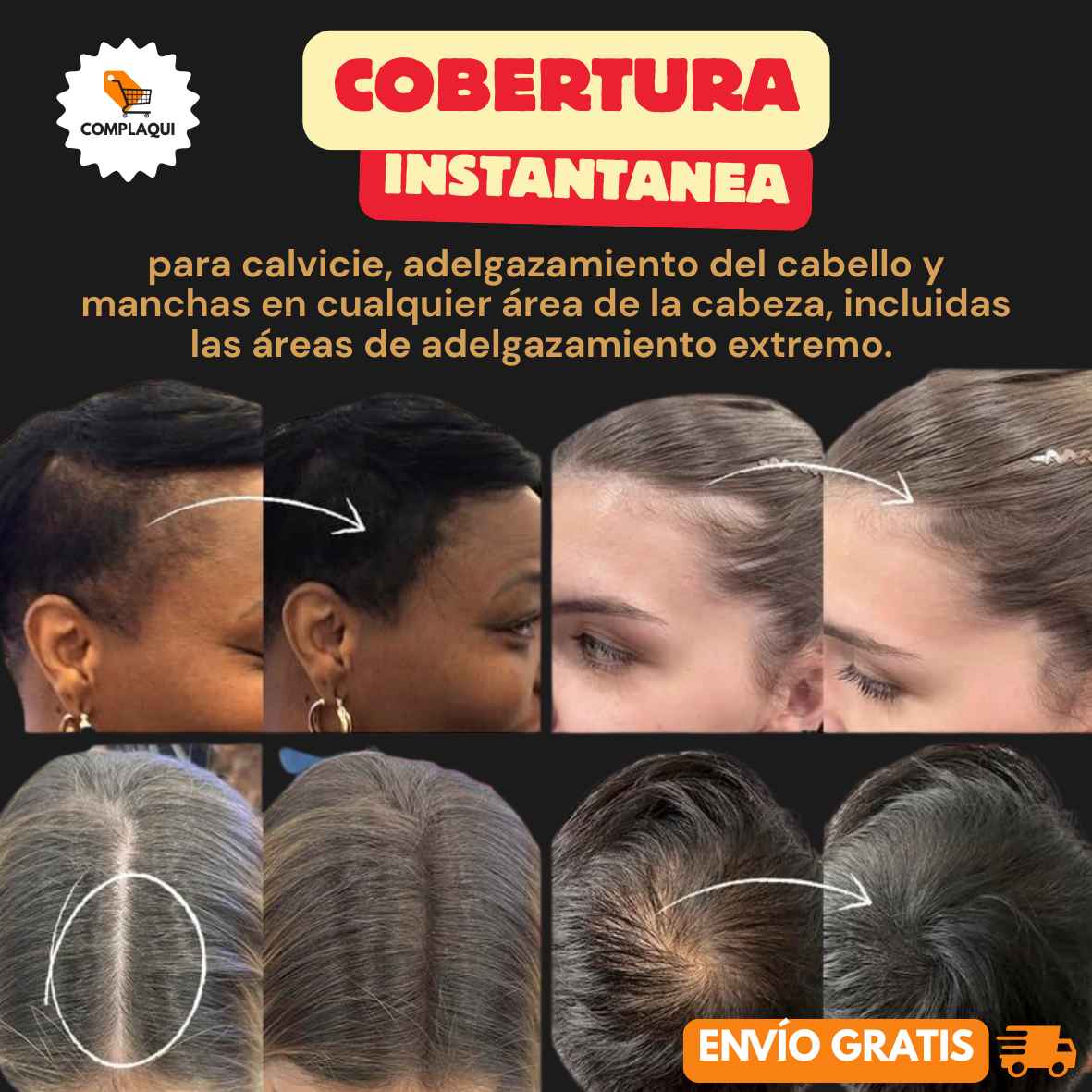 REGENESIS® RELLENO DE DENSIDAD CAPILAR Y TAPA CANAS